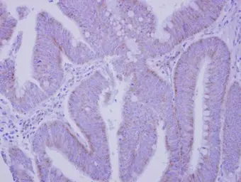 Anti-Integrin alpha V antibody [C2C3], C-term used in IHC (Paraffin sections) (IHC-P). GTX100789