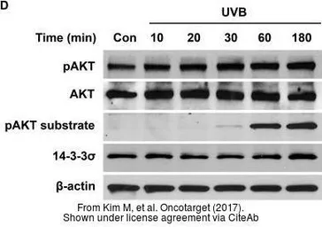 Anti-14-3-3 sigma antibody used in Western Blot (WB). GTX100801