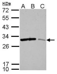 Anti-14-3-3 sigma antibody used in Western Blot (WB). GTX100801