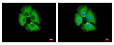 Anti-14-3-3 sigma antibody used in Immunocytochemistry/ Immunofluorescence (ICC/IF). GTX100801
