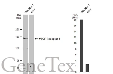Anti-VEGF Receptor 3 antibody used in Western Blot (WB). GTX100807