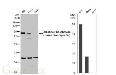 Anti-Alkaline Phosphatase (Tissue Non-Specific) antibody used in Western Blot (WB). GTX100817