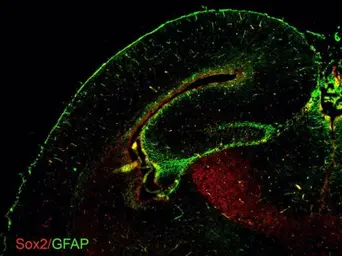 Anti-GFAP antibody used in IHC (Frozen sections) (IHC-Fr). GTX100850