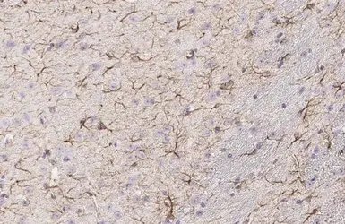Anti-GFAP antibody used in IHC (Paraffin sections) (IHC-P). GTX100850