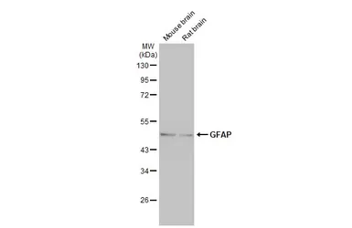 Anti-GFAP antibody used in Western Blot (WB). GTX100850