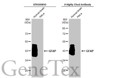 Anti-GFAP antibody used in Western Blot (WB). GTX100850