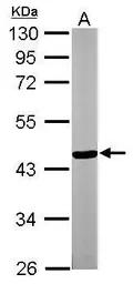 Anti-TTLL1 antibody [N1C3] used in Western Blot (WB). GTX100853