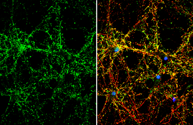 Anti-Synaptophysin antibody used in Immunocytochemistry/ Immunofluorescence (ICC/IF). GTX100865