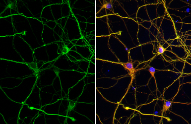 Anti-Tau antibody used in Immunocytochemistry/ Immunofluorescence (ICC/IF). GTX100866