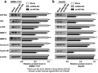 Anti-Cyclin B1 antibody used in Western Blot (WB). GTX100911