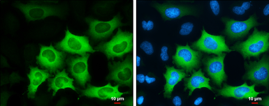 Anti-Cyclin B1 antibody used in Immunocytochemistry/ Immunofluorescence (ICC/IF). GTX100911