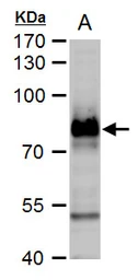 Anti-B-Raf antibody [N2C1], Internal used in Western Blot (WB). GTX100913