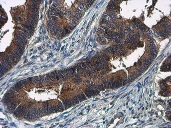 Anti-Amphiregulin antibody used in IHC (Paraffin sections) (IHC-P). GTX100986