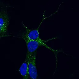 Anti-VPS35 antibody, C-term used in Immunocytochemistry/ Immunofluorescence (ICC/IF). GTX10099
