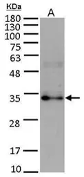 Anti-FGF10 antibody used in Western Blot (WB). GTX101005