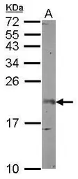 Anti-FGF12 antibody used in Western Blot (WB). GTX101007