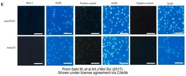 Anti-PTEN antibody used in Immunocytochemistry/ Immunofluorescence (ICC/IF). GTX101025