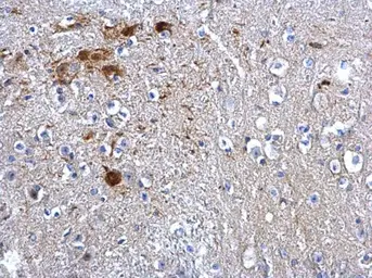 Anti-PTEN antibody used in IHC (Paraffin sections) (IHC-P). GTX101025
