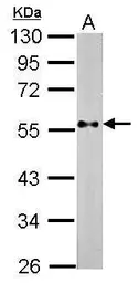 Anti-PTEN antibody used in Western Blot (WB). GTX101025