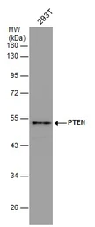 Anti-PTEN antibody used in Western Blot (WB). GTX101025