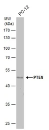 Anti-PTEN antibody used in Western Blot (WB). GTX101025