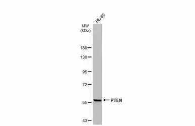 Anti-PTEN antibody used in Western Blot (WB). GTX101025