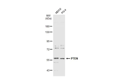 Anti-PTEN antibody used in Western Blot (WB). GTX101025