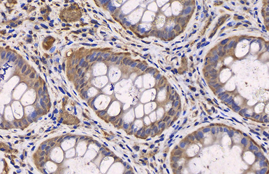 Anti-PTEN antibody used in IHC (Paraffin sections) (IHC-P). GTX101025