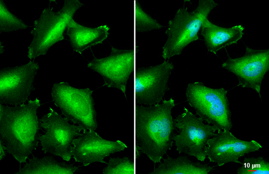 Anti-Annexin A1 antibody used in Immunocytochemistry/ Immunofluorescence (ICC/IF). GTX101070