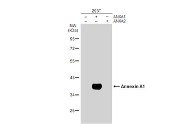 Anti-Annexin A1 antibody used in Western Blot (WB). GTX101070