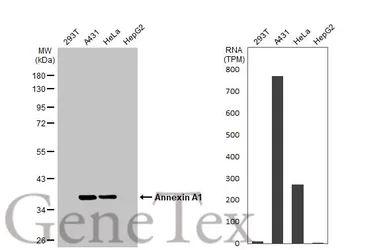 Anti-Annexin A1 antibody used in Western Blot (WB). GTX101070
