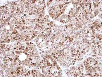 Anti-Annexin A1 antibody used in IHC (Paraffin sections) (IHC-P). GTX101070