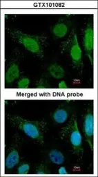 Anti-WRN antibody [C3], C-term used in Immunocytochemistry/ Immunofluorescence (ICC/IF). GTX101082