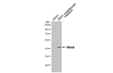 Anti-Wnt4 antibody used in Western Blot (WB). GTX101085