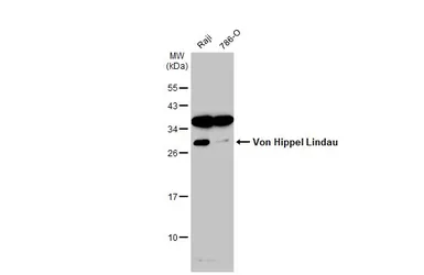Anti-Von Hippel Lindau antibody used in Western Blot (WB). GTX101087