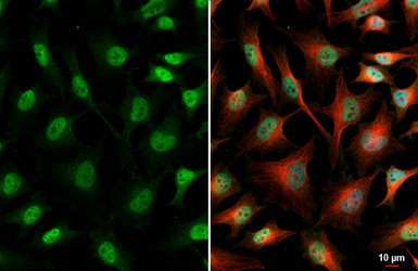 Anti-Von Hippel Lindau antibody used in Immunocytochemistry/ Immunofluorescence (ICC/IF). GTX101087