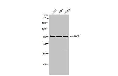 Anti-VCP antibody used in Western Blot (WB). GTX101089