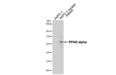 Anti-PPAR alpha antibody used in Western Blot (WB). GTX101098