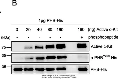 Anti-Prohibitin antibody used in Western Blot (WB). GTX101105