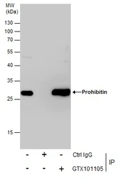 Anti-Prohibitin antibody used in Immunoprecipitation (IP). GTX101105