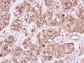 Anti-Prohibitin antibody used in IHC (Paraffin sections) (IHC-P). GTX101105