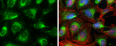 Anti-Prohibitin antibody used in Immunocytochemistry/ Immunofluorescence (ICC/IF). GTX101105