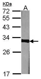 Anti-Prohibitin antibody used in Western Blot (WB). GTX101105