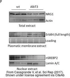 Anti-Neuregulin-1 antibody used in Western Blot (WB). GTX101117