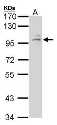 Anti-Glucocorticoid Receptor antibody used in Western Blot (WB). GTX101120