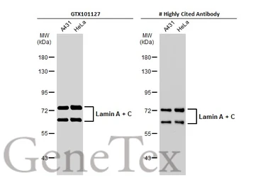 Anti-Lamin A + C antibody used in Western Blot (WB). GTX101127