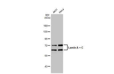 Anti-Lamin A + C antibody used in Western Blot (WB). GTX101127