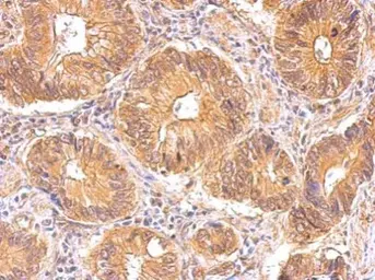 Anti-Insulin Receptor beta antibody used in IHC (Paraffin sections) (IHC-P). GTX101136