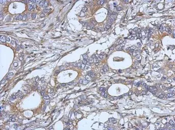 Anti-IL2 antibody used in IHC (Paraffin sections) (IHC-P). GTX101138