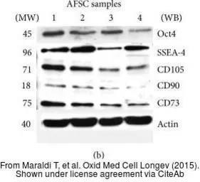 Anti-CD73 antibody [N3C3] used in Western Blot (WB). GTX101140